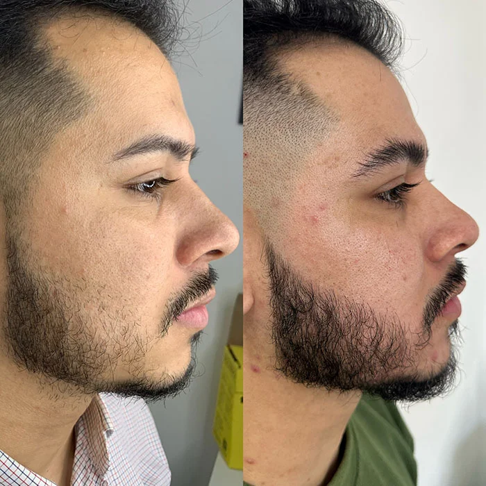 Barba